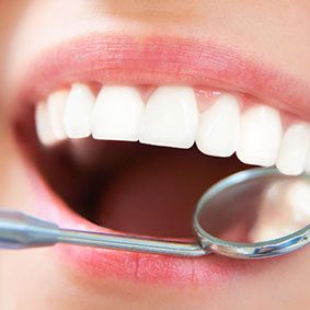 TeethWhitening TeethWhitening